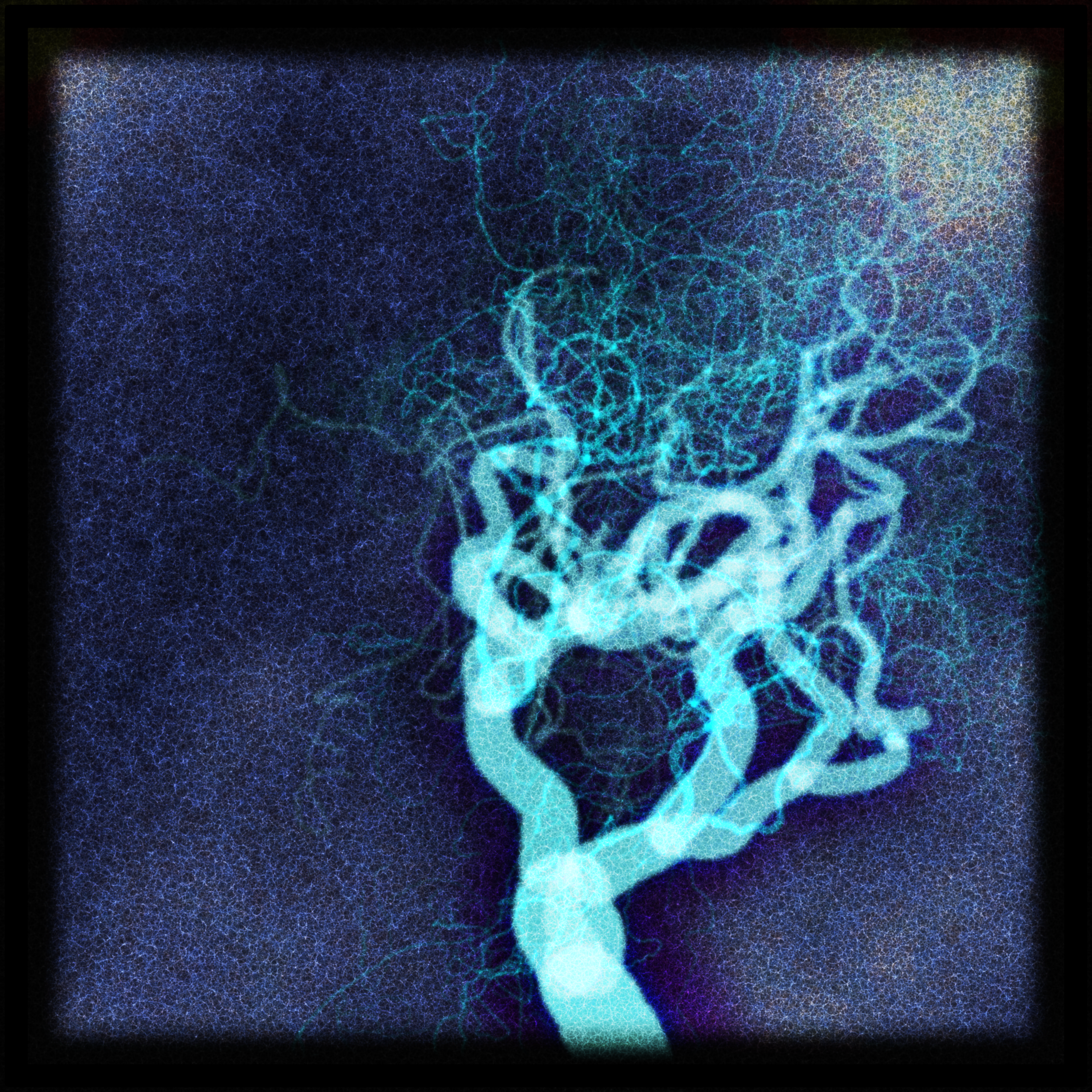 Generative image of a tree as a glowing blue network on a dark ground, its branches luminous filaments like nerves or vessels strung with bright nodes - the natural and the fabricated intertwined.